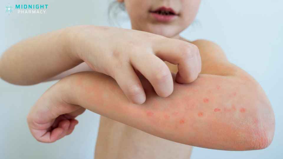 chickenpox vaccine bradford