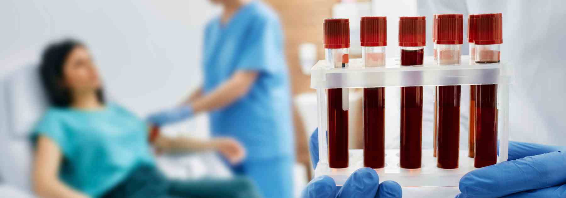 Private blood tests in Bradford