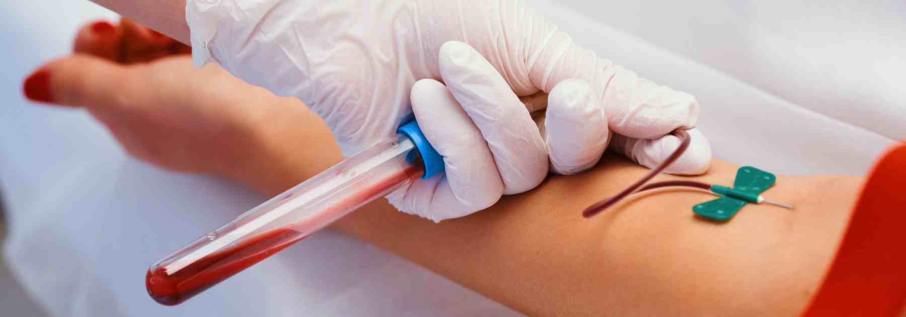 Book blood test services in Bradford today. 