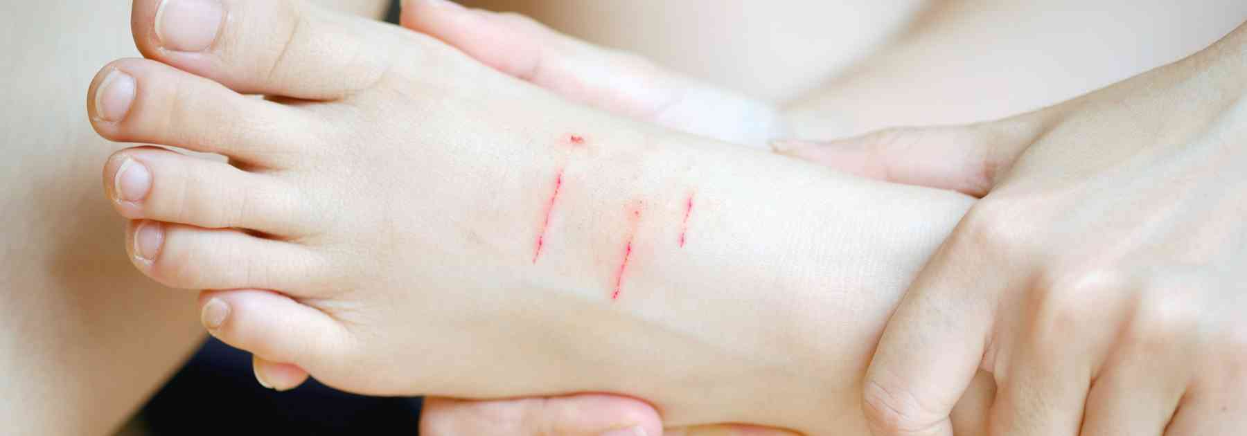 Why get the Rabies jab in Bradford?