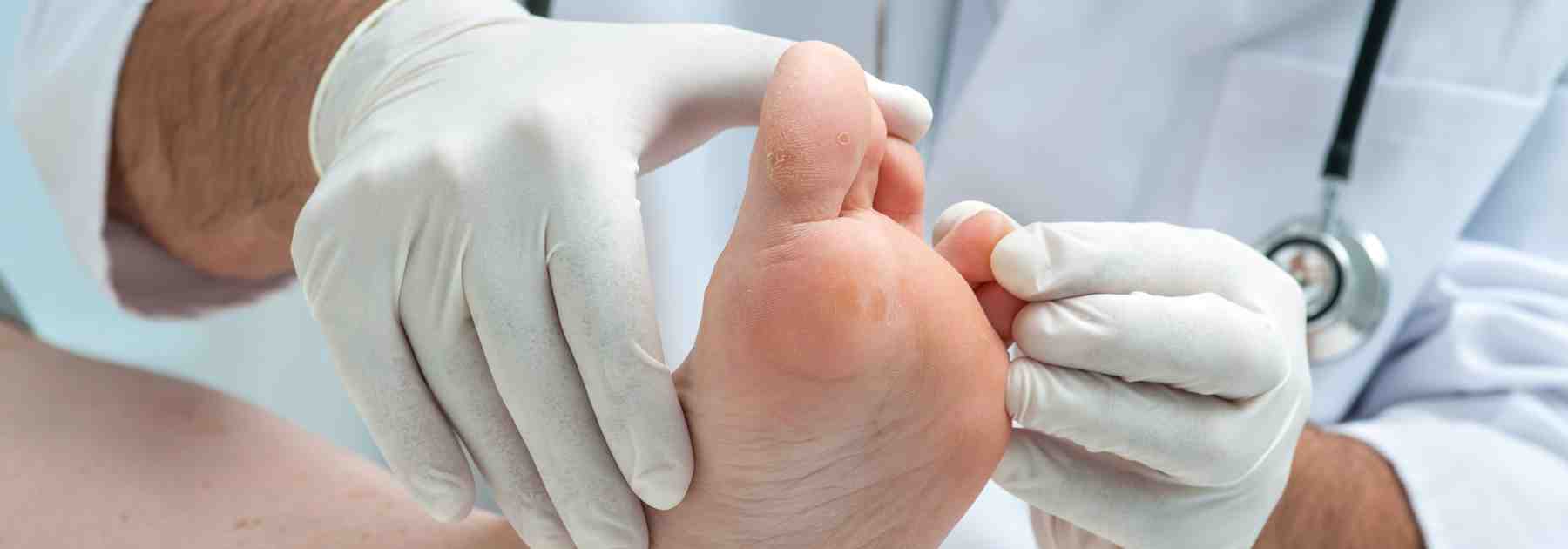 Buy athlete's foot cream