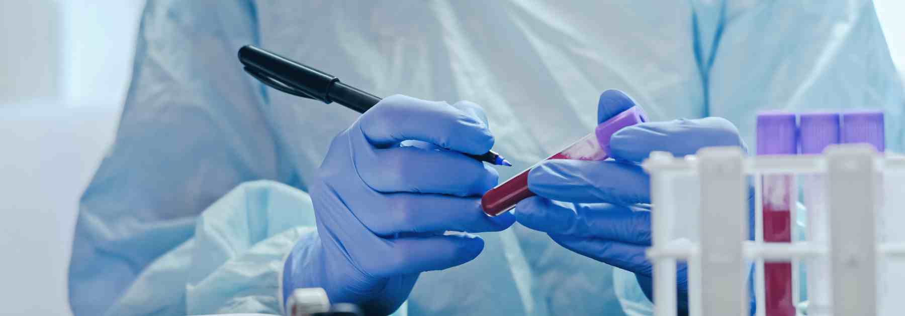 Private blood testing tubes