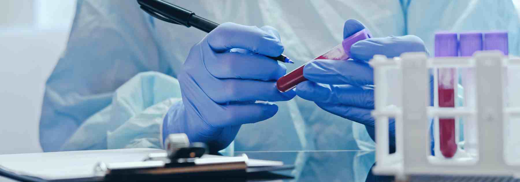 Testing blood samples