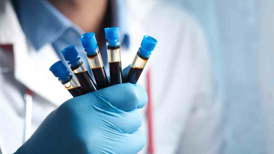 Blood testing tubes