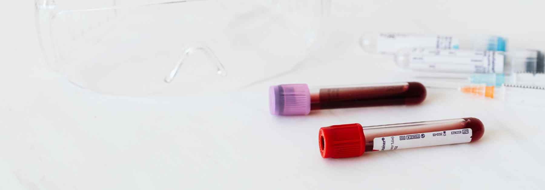 Blood testing in Bradford