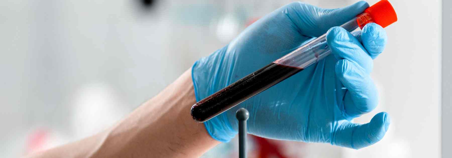 Holding a blood test tube