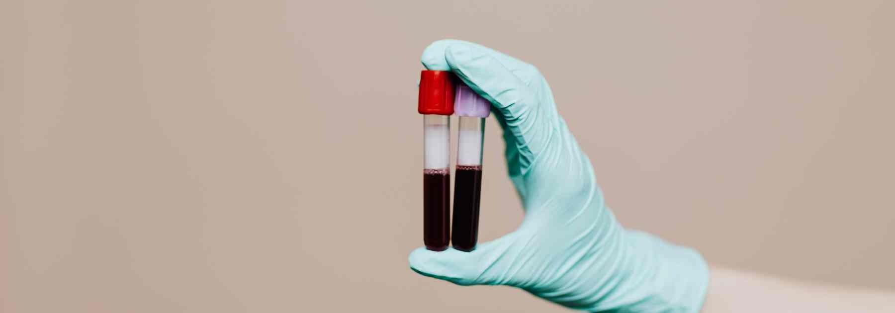 Blood tests tubes
